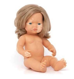Muñeca caucásica rubia oscuro con vitíligo 38cm